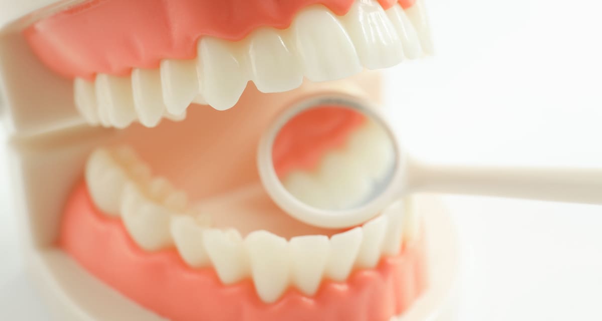 periimplantitis que es