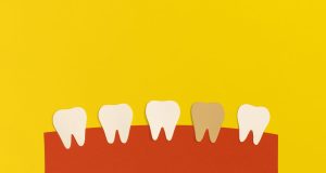 dientes amarillos