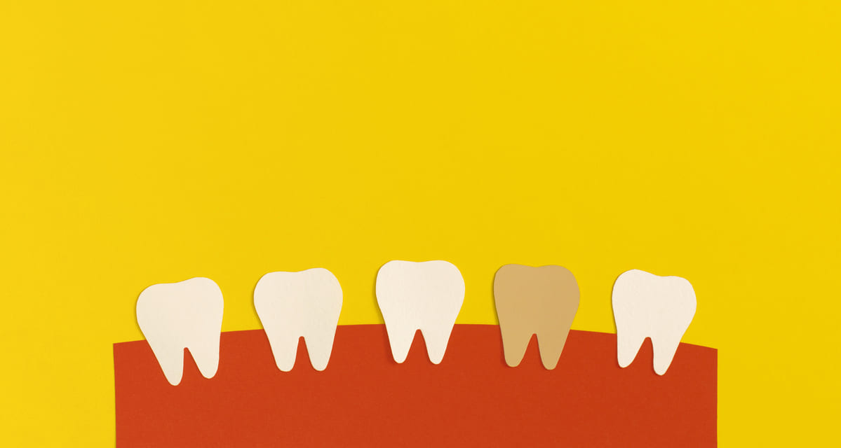 dientes amarillos
